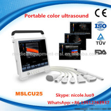 MSLCU25-I 2016 Advanced laptop color doppler ultrasound machine/color doppler echo machine